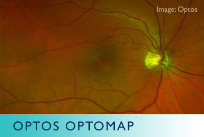 optomap